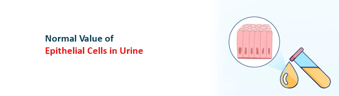 Normal Value of Epithelial Cells in Urine